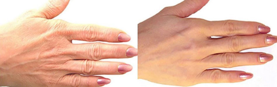 Alpeja Cosmetics Natural Cosmetic Slovenia